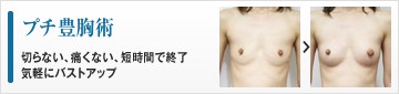 プチ豊胸術　切らない、痛くない、短時間で終了　気軽にバストアップ