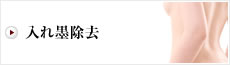 入れ墨除去