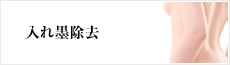 入れ墨除去