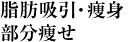 脂肪吸引・痩身・部分痩せ