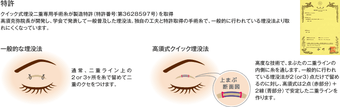 特許