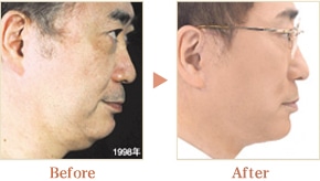 ビフォーアフター