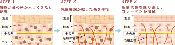 STEP1 細胞が金の糸が入ってきたと認識　STEP2 免疫細胞が戦った傷を修復　STEP3 新陳代謝を繰り返し、コラーゲンが増殖