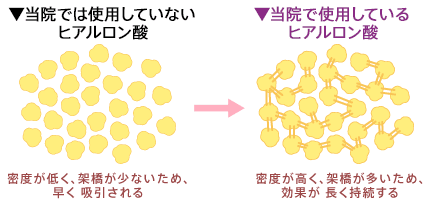従来のヒアルロン酸:密度が低く、架橋が少ないため、早く吸収される→当院のヒアルロン酸:密度が高く、架橋が多いため、効果が、長く持続する