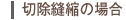 切除縫縮の場合