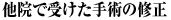 他院で受けた手術の修正