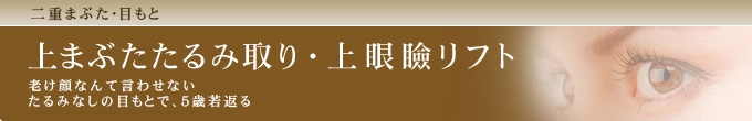 上まぶたたるみ取り・上眼瞼リフト