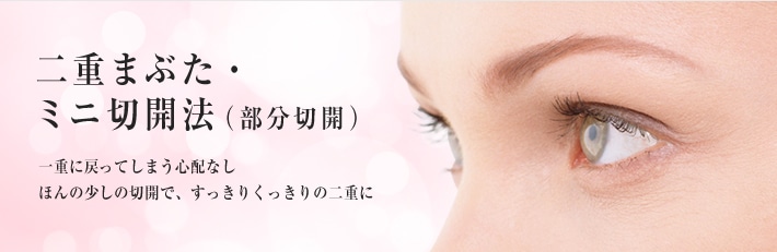 二重まぶた・ミニ切開法(部分切開) 一重に戻ってしまう心配なし ほんの少しの切開で、すっきりくっきりの二重に