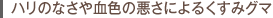 ハリのなさや血色の悪さによるくすみグマ