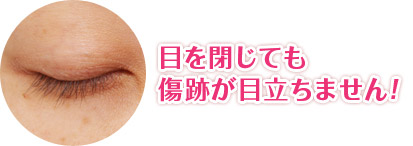 目を閉じても傷跡が目立ちません!