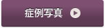 症例のご紹介