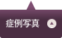 症例のご紹介