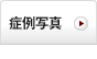 症例写真
