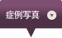 症例のご紹介