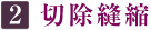 2.切除縫縮