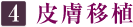 4.皮膚移植