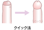 クイック法