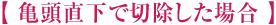亀頭直下で切除した場合