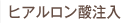 ヒアルロン酸注入
