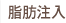 脂肪注入