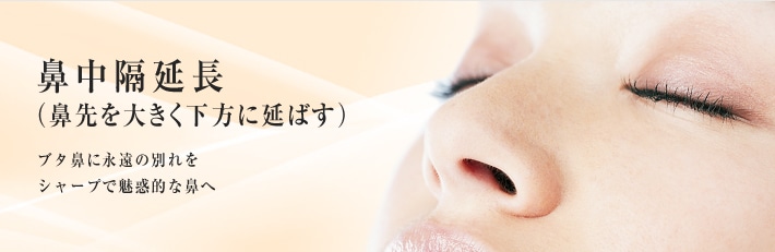 鼻中隔延長（鼻先を大きく下方に延ばす）　ブタ鼻に永遠の別れをシャープで魅惑的な鼻へ