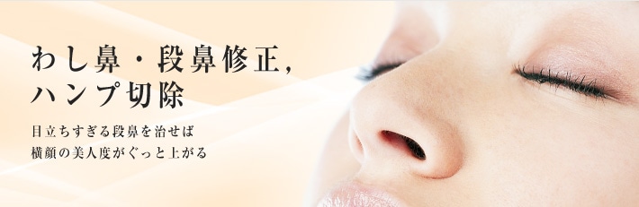 ハンプ切除（わし鼻・段鼻修正）　目立ちすぎる段鼻を治せば　横顔の美人度がぐっと上がる