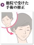 他院で受けた手術の修正