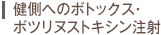 健側へのボトックス注射