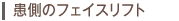 患側のフェイスリフト