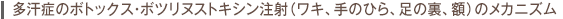 多汗症のボトックス注射(ワキ、手のひら、足の裏、額)のメカニズム