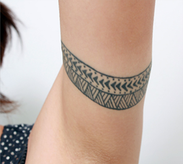 刺青（タトゥー）除去,二の腕の入れ墨切除縫縮した症例写真,Before,ba_irezumi19_b.jpg