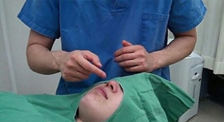 鼻先の耳介軟骨移植キャプチャ（写真）解説