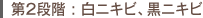 第2段階:白ニキビ、黒ニキビ