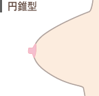 円錐型
