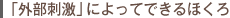 「外部刺激」によってできるほくろ
