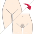 薄い陰毛には