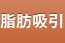 脂肪吸引(スムースライポサクション法)