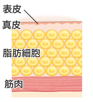 ラク して やせ たい 美容整形の高須クリニック ラク して やせ たい 美容整形の高須クリニック