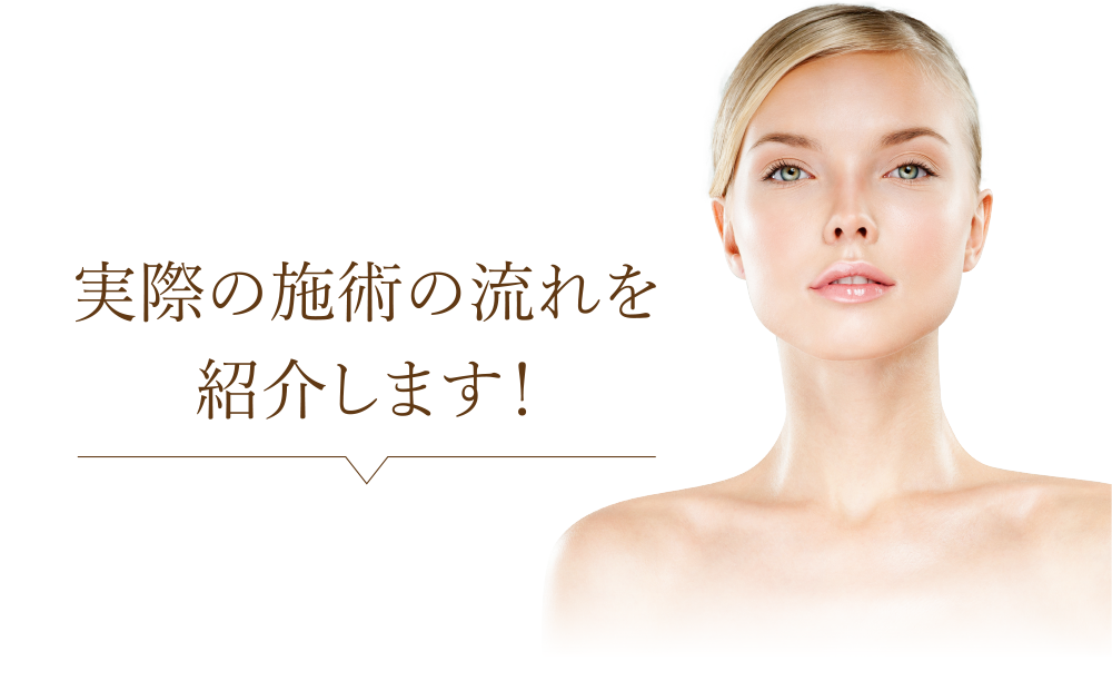 実際の施術の流れを紹介します!