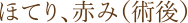 ほてり、赤み(術後)