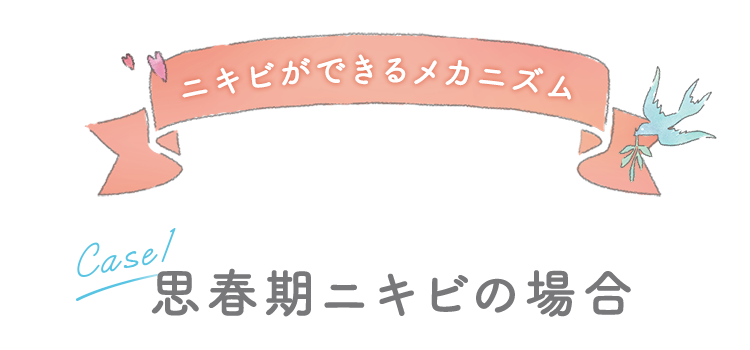 ニキビができるメカニズム [Case1]思春期ニキビの場合