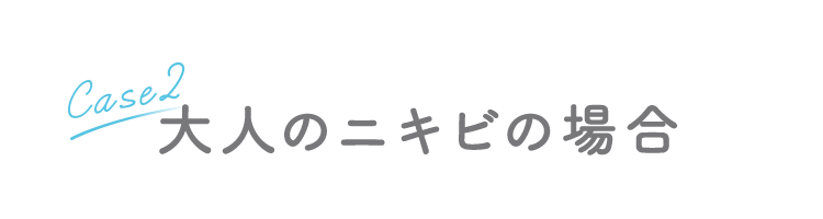 [Case2]大人のニキビの場合