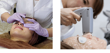 ｢マッサージピール｣ / ｢トリニティプラス｣