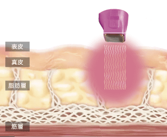 均一に加熱し脂肪層までアプローチ