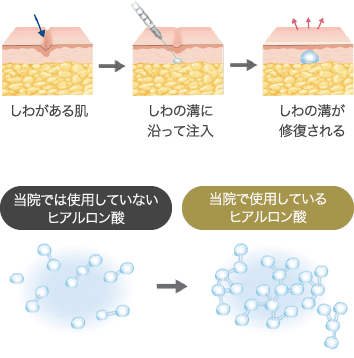 ヒアルロン酸とは？