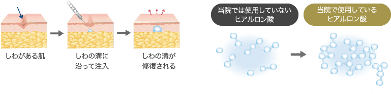 ヒアルロン酸とは？