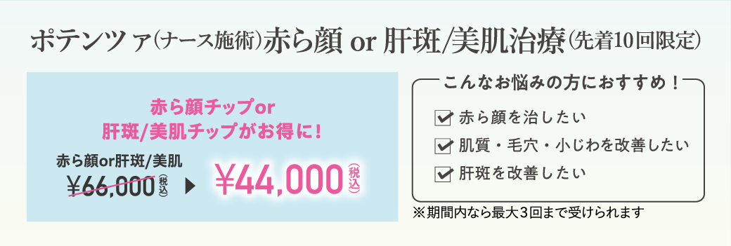 ポテンツァ（ナース施術）赤ら顔チップor肝斑・美肌チップがお得に！（先着10回限定）/￥44,000（税込）/こんなお悩みの方におすすめ！✓赤ら顔を治したい、✓肌質・毛穴・小じわを改善したい、✓肝斑を改善したい/※期間内なら最大3回まで受けられます