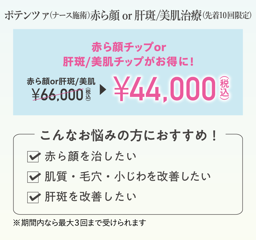 ポテンツァ（ナース施術）赤ら顔チップor肝斑・美肌チップがお得に！（先着10回限定）/￥44,000（税込）/こんなお悩みの方におすすめ！✓赤ら顔を治したい、✓肌質・毛穴・小じわを改善したい、✓肝斑を改善したい/※期間内なら最大3回まで受けられます