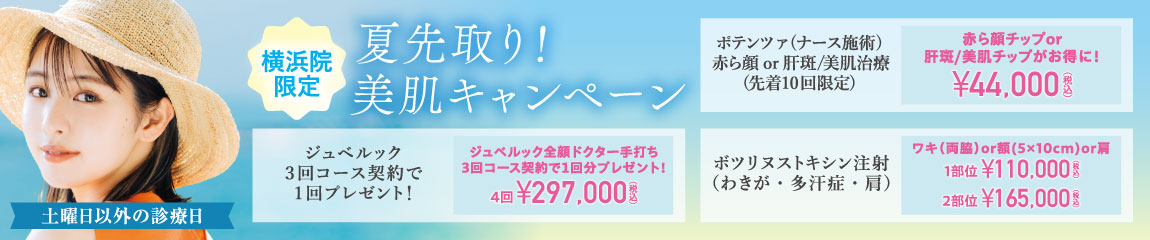 夏先取り！美肌キャンペーン/ジュベルック、ボツリヌストキシン注射、ポテンツァ（ナース施術）/横浜院限定/土曜日以外の診療日/7月末まで