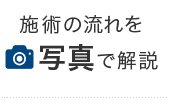 施術の流れを写真で解説